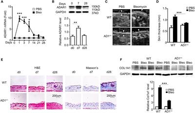 ADAR1 promotes systemic sclerosis via modulating classic macrophage activation